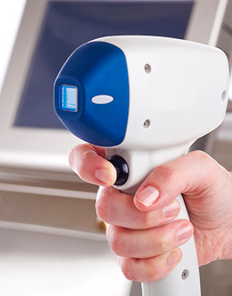 Laser hair removal